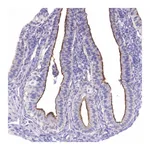 Atlas Antibodies Anti-AP5B1 Antibody