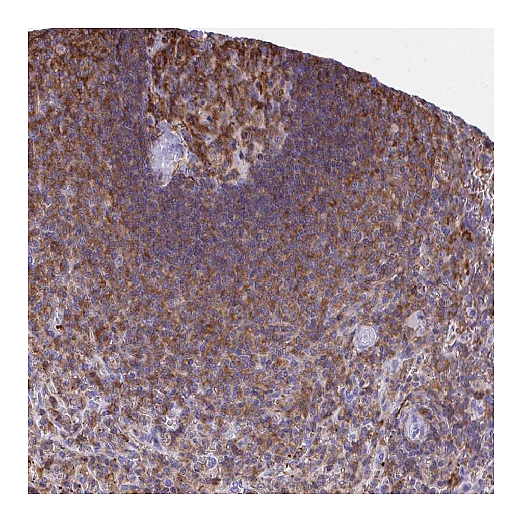 Atlas Antibodies Anti-AP5M1 Antibody