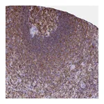 Atlas Antibodies Anti-AP5M1 Antibody