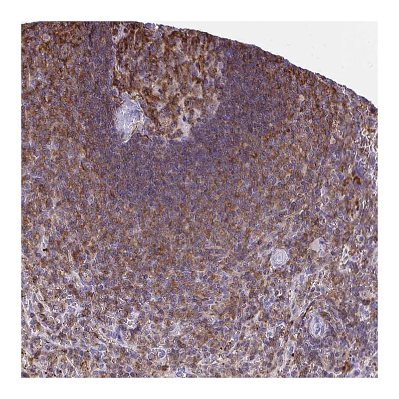 Atlas Antibodies Anti-AP5M1 Antibody