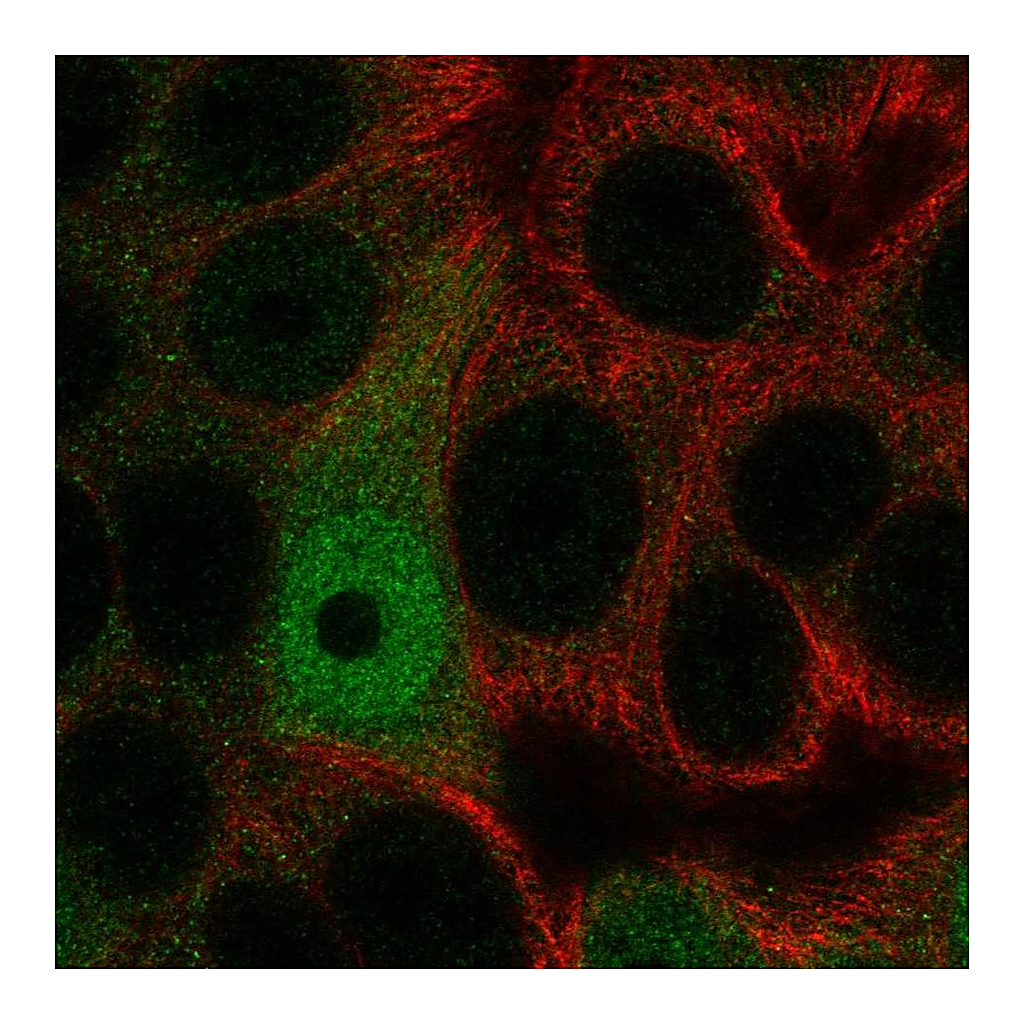 Atlas Antibodies Anti-AP5S1 Antibody