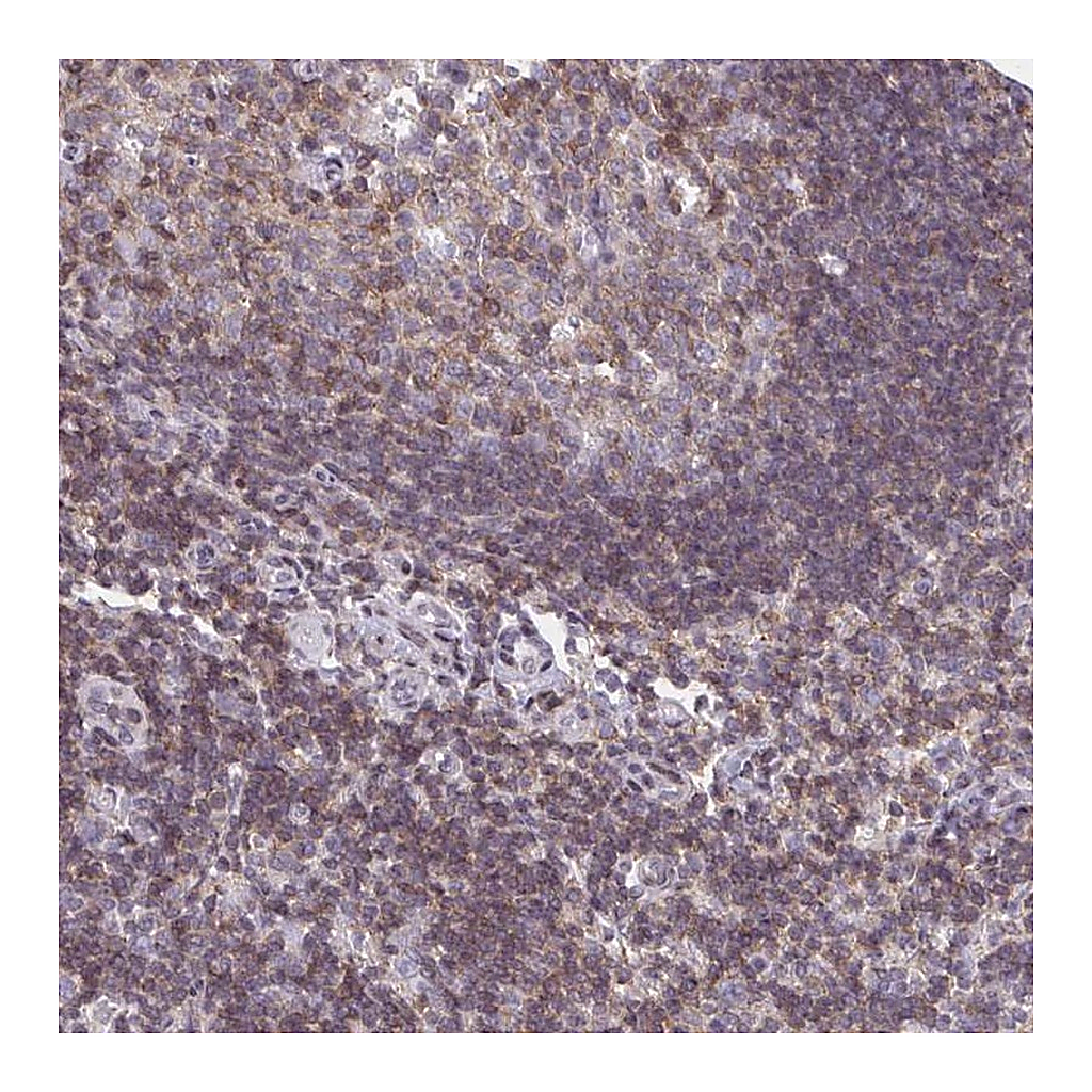 Atlas Antibodies Anti-AP5M1 Antibody