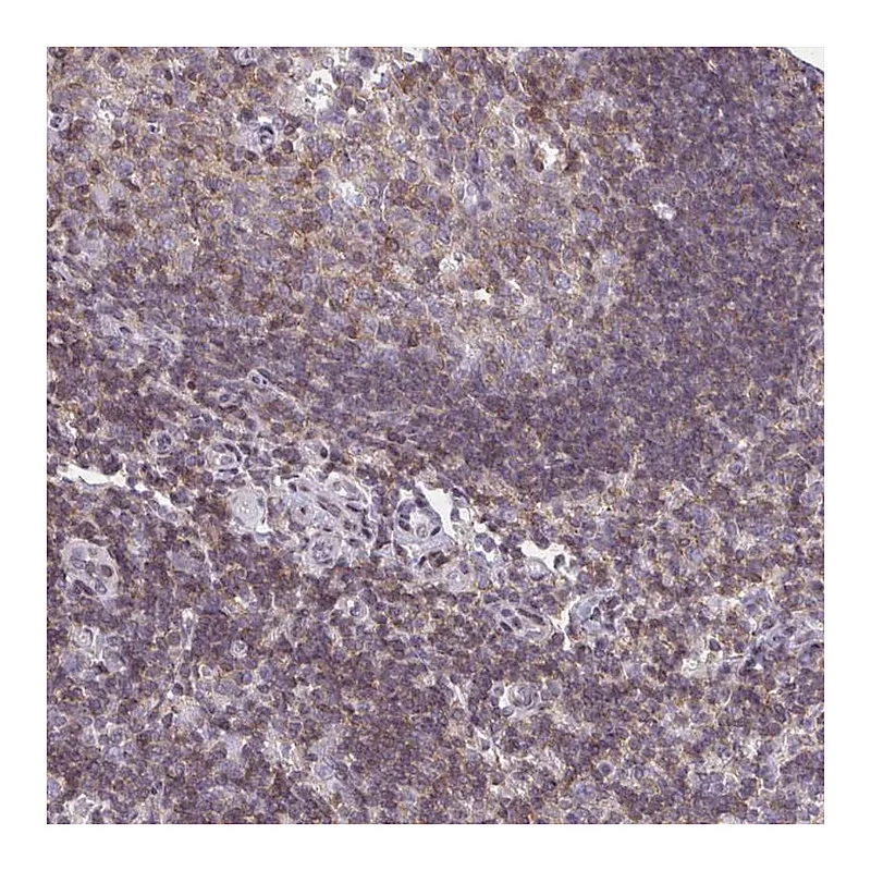 Atlas Antibodies Anti-AP5M1 Antibody