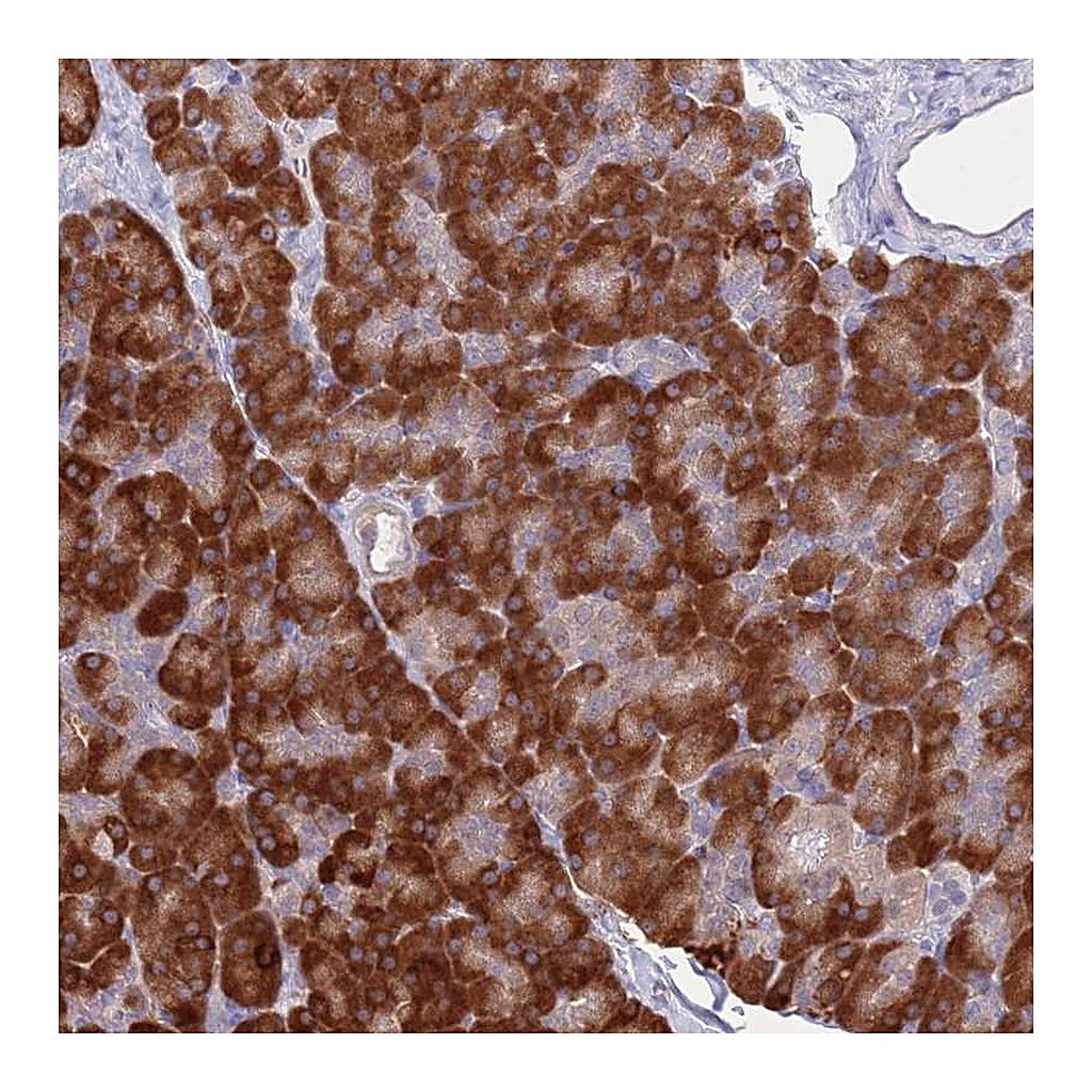 Atlas Antibodies Anti-AP5S1 Antibody