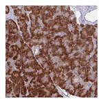 Atlas Antibodies Anti-AP5S1 Antibody