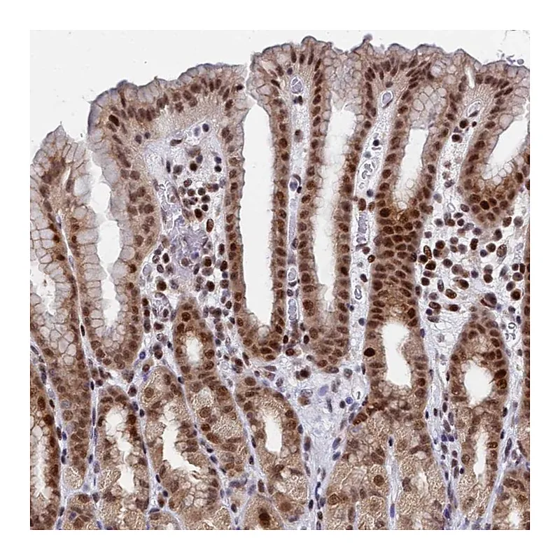 Atlas Antibodies Anti-AP5Z1 Antibody