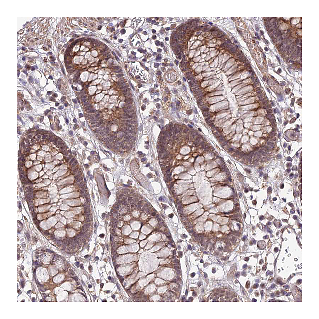 Atlas Antibodies Anti-APBA3 Antibody