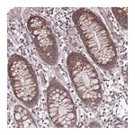 Atlas Antibodies Anti-APBA3 Antibody