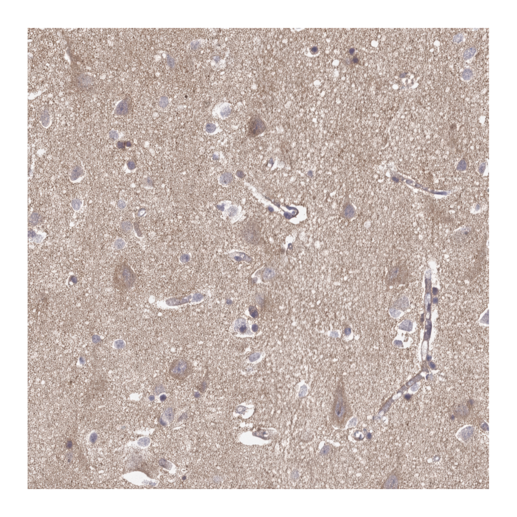 Atlas Antibodies Anti-APBB1 Antibody