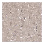 Atlas Antibodies Anti-APBB1 Antibody