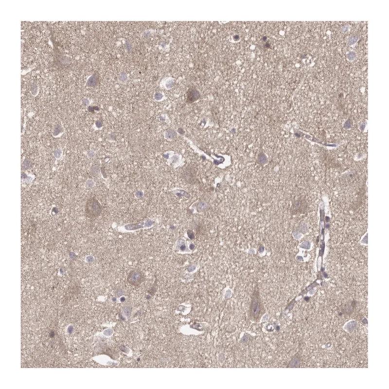 Atlas Antibodies Anti-APBB1 Antibody