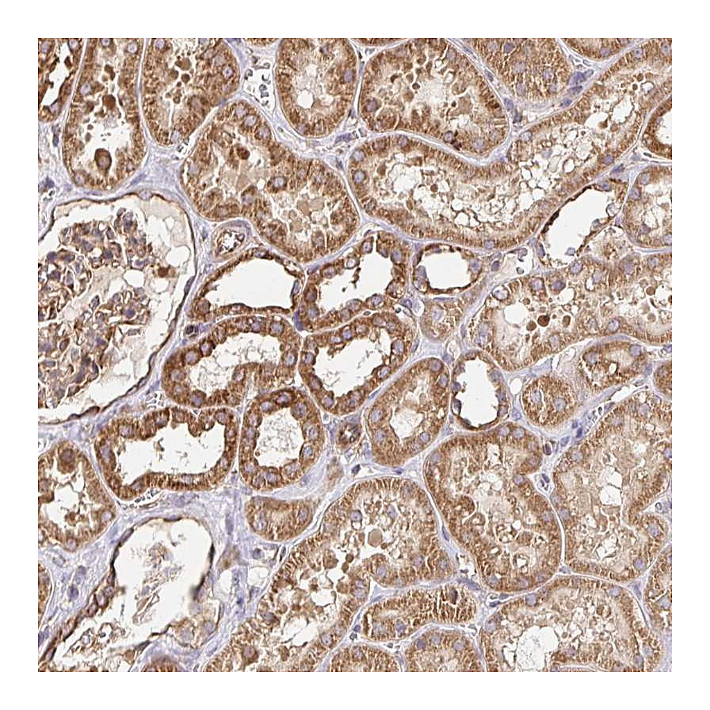 Atlas Antibodies Anti-APBB1 Antibody