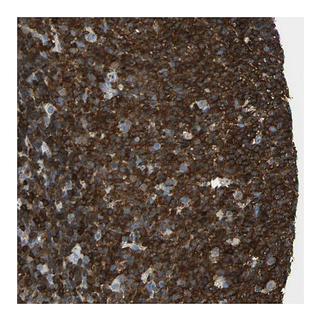 Atlas Antibodies Anti-APBB3 Antibody