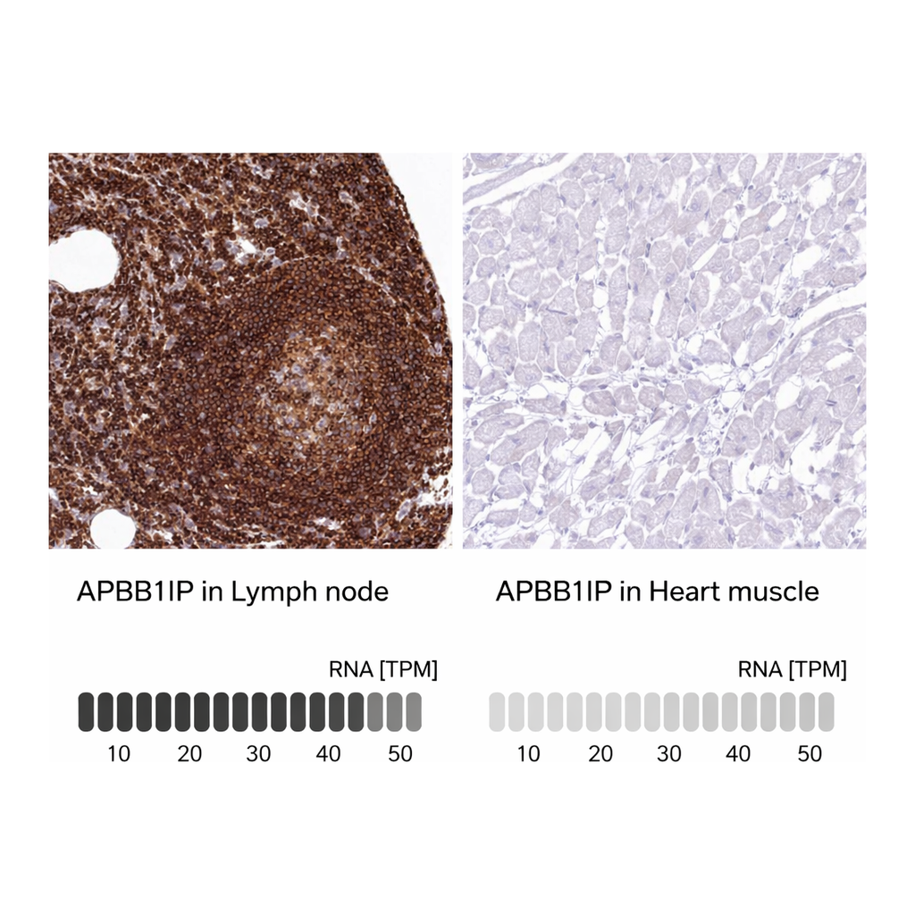 Atlas Antibodies Anti-APBB1IP Antibody
