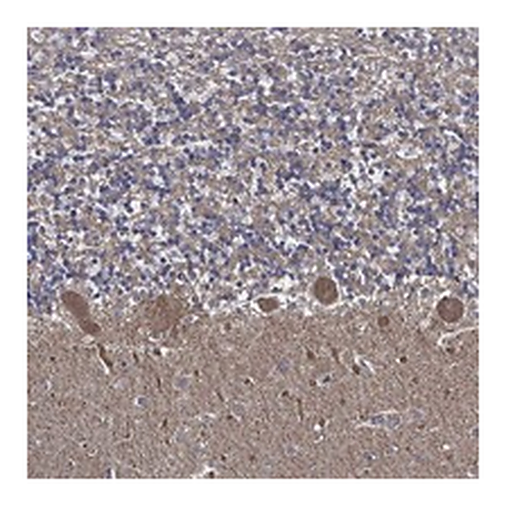 Atlas Antibodies Anti-APBB3 Antibody