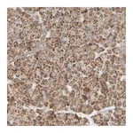 Atlas Antibodies Anti-APBB2 Antibody