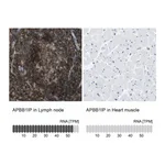 Atlas Antibodies Anti-APBB1IP Antibody