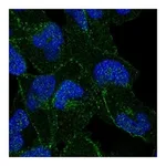 Atlas Antibodies Anti-APC Antibody