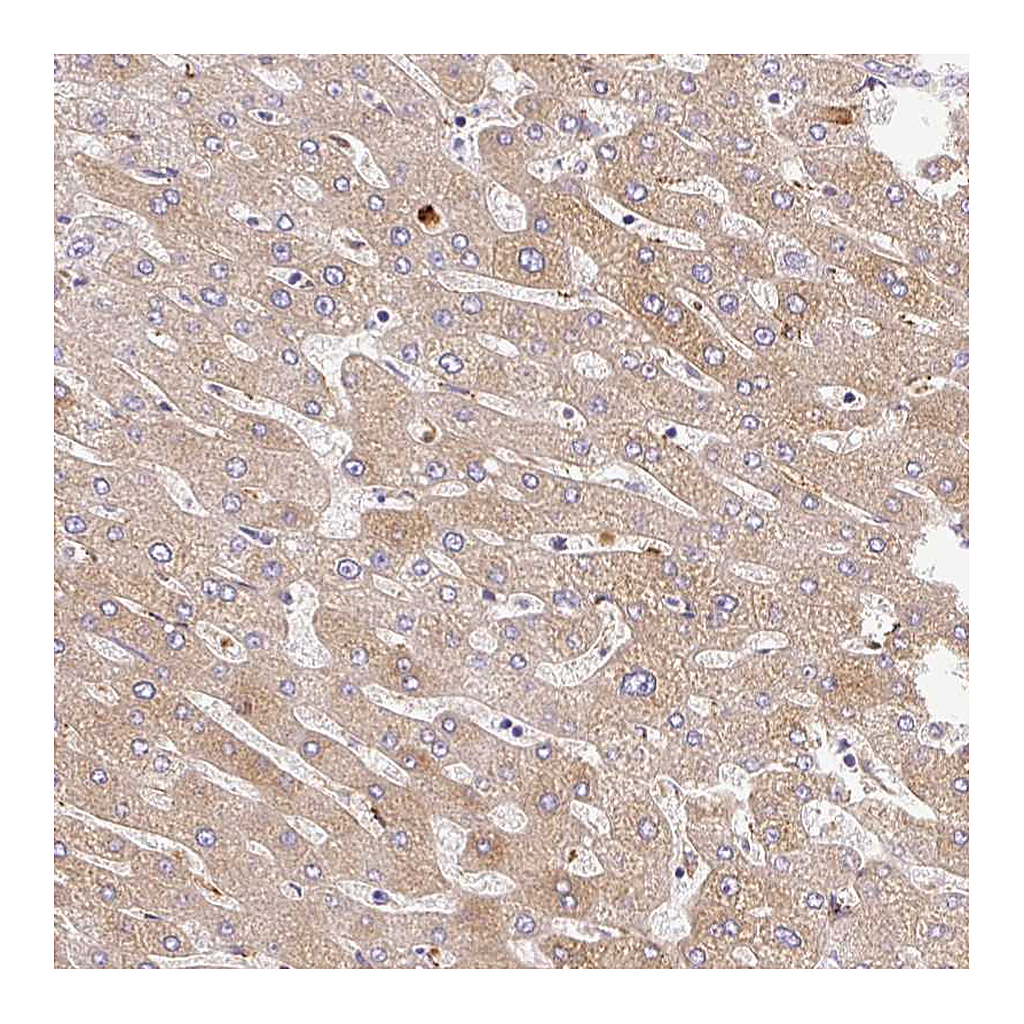 Atlas Antibodies Anti-APCS Antibody