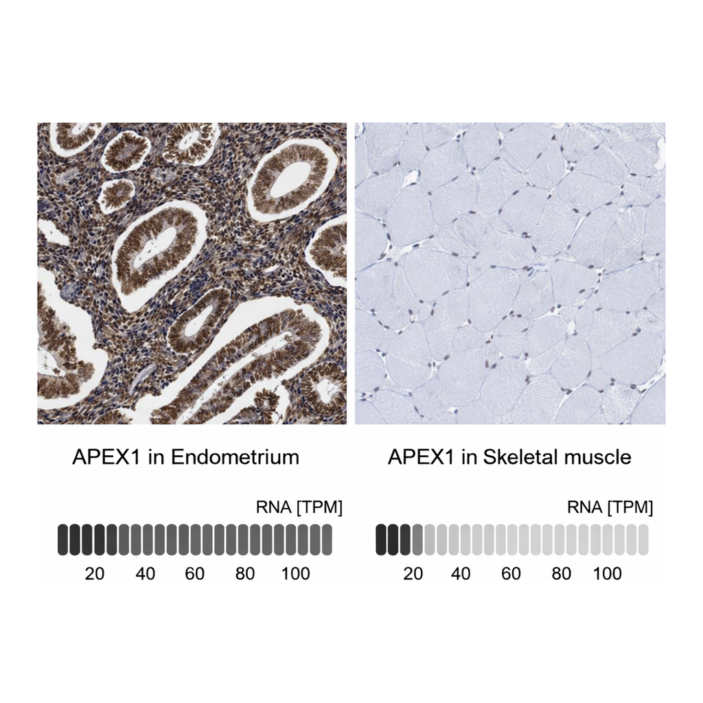 Atlas Antibodies Anti-APEX1 Antibody