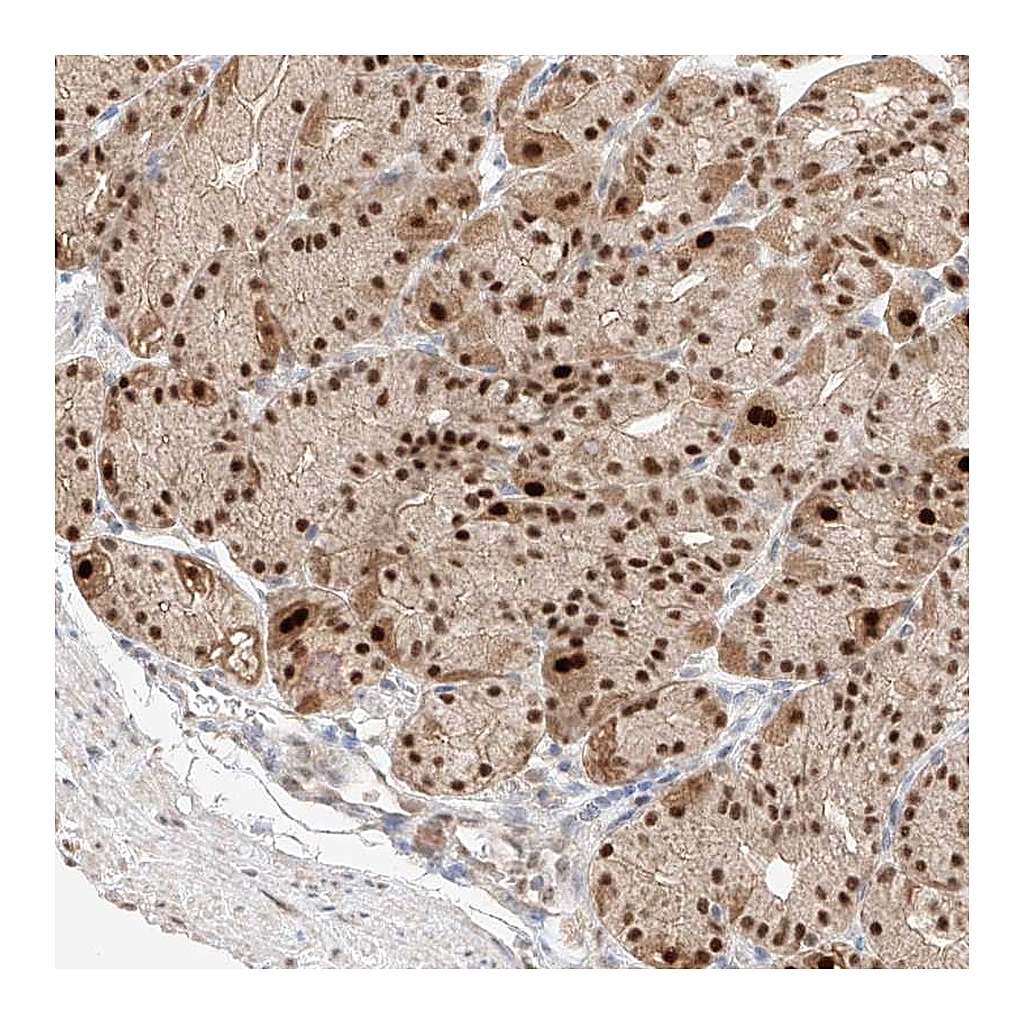 Atlas Antibodies Anti-APIP Antibody