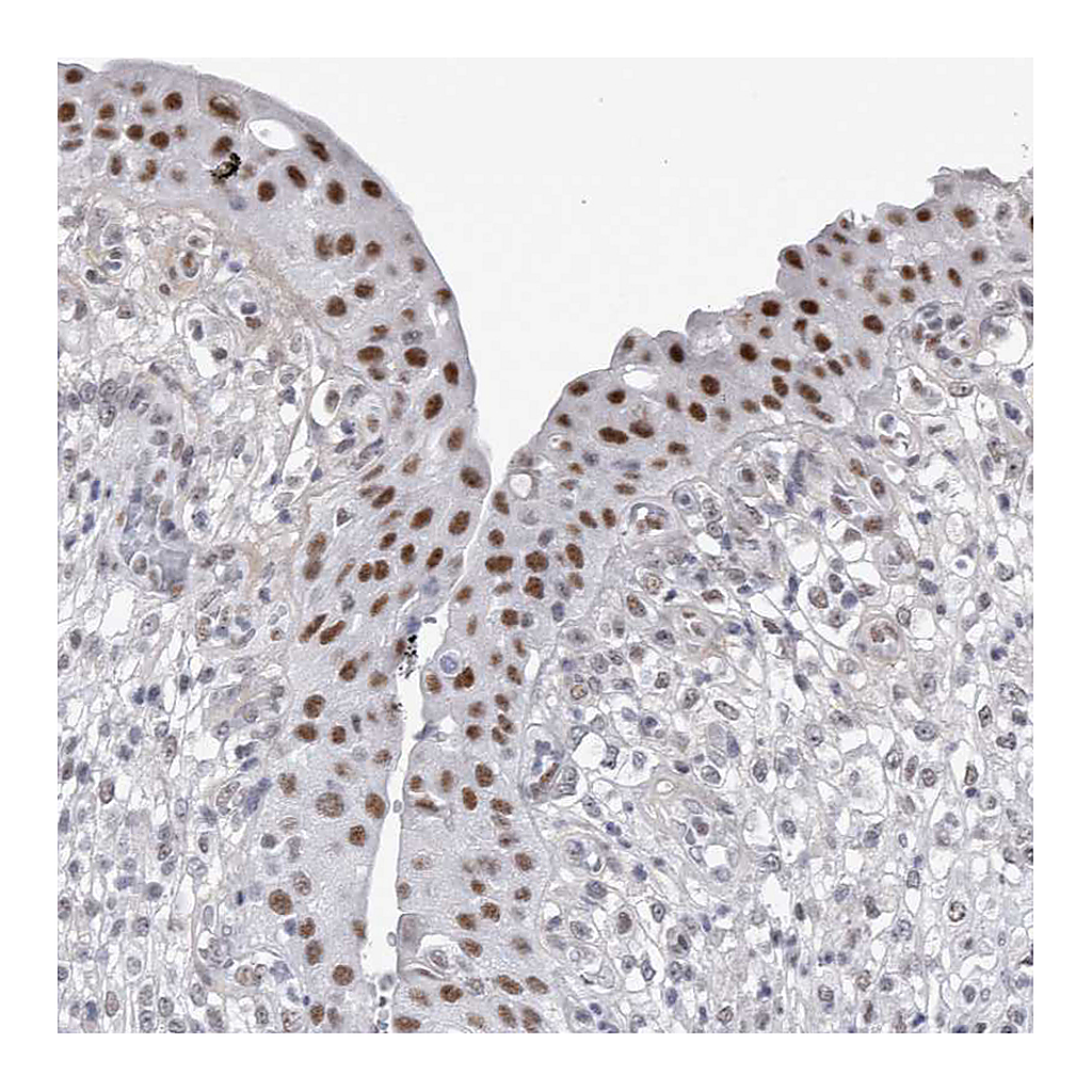 Atlas Antibodies Anti-API5 Antibody