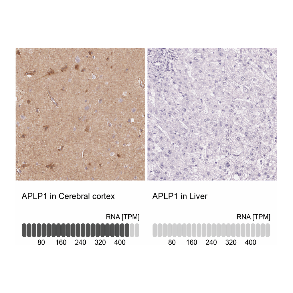 Atlas Antibodies Anti-APLP1 Antibody