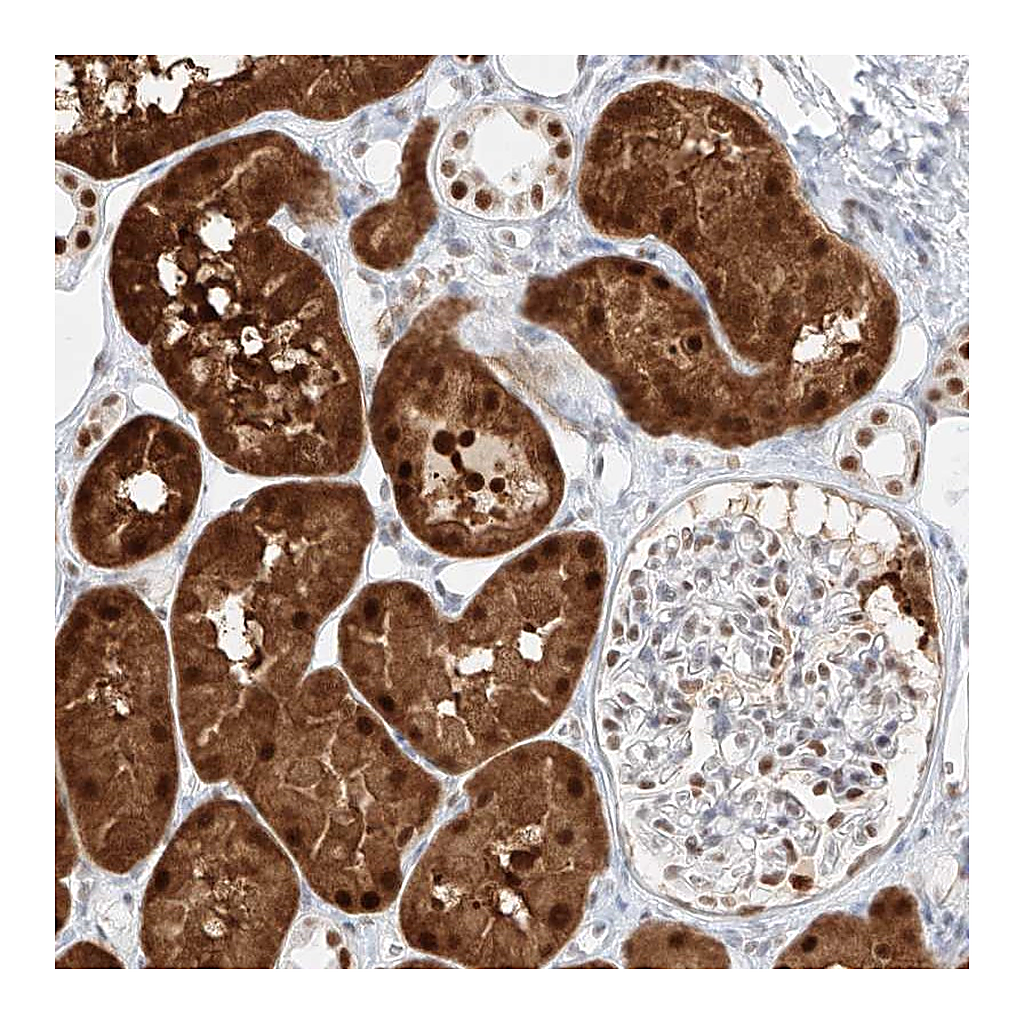 Atlas Antibodies Anti-APIP Antibody