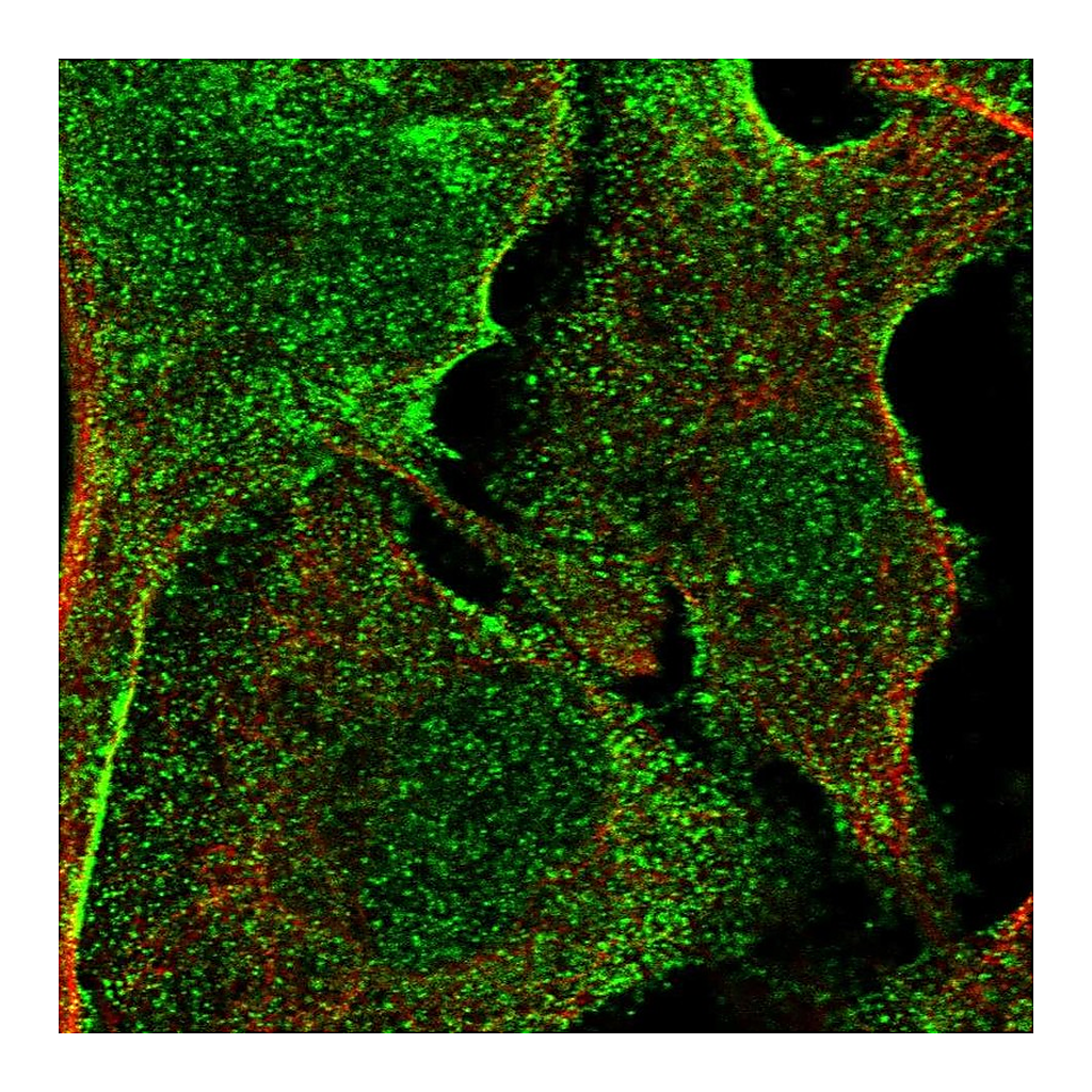 Atlas Antibodies Anti-APMAP Antibody