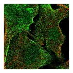 Atlas Antibodies Anti-APMAP Antibody