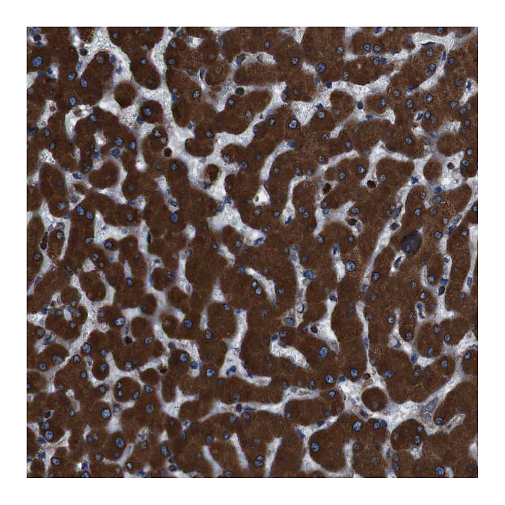 Atlas Antibodies Anti-APMAP Antibody