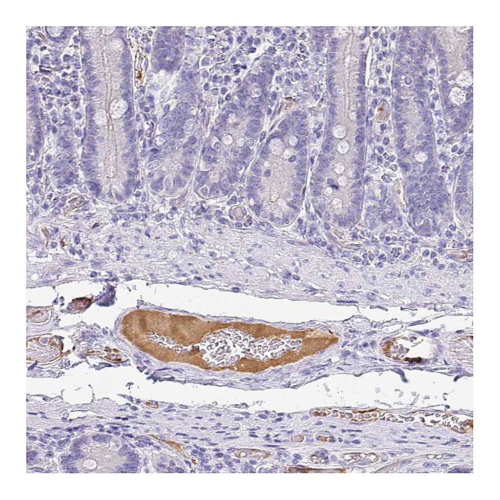 Atlas Antibodies Anti-APOB Antibody