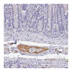 Atlas Antibodies Anti-APOB Antibody