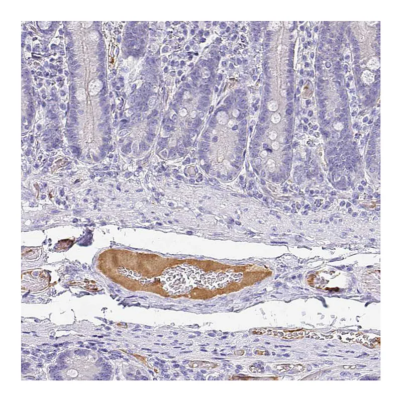 Atlas Antibodies Anti-APOB Antibody