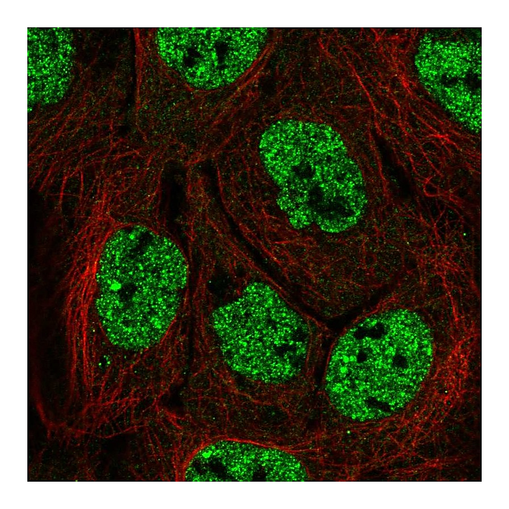 Atlas Antibodies Anti-APOBEC3B Antibody
