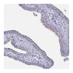 Atlas Antibodies Anti-APOBEC3H Antibody