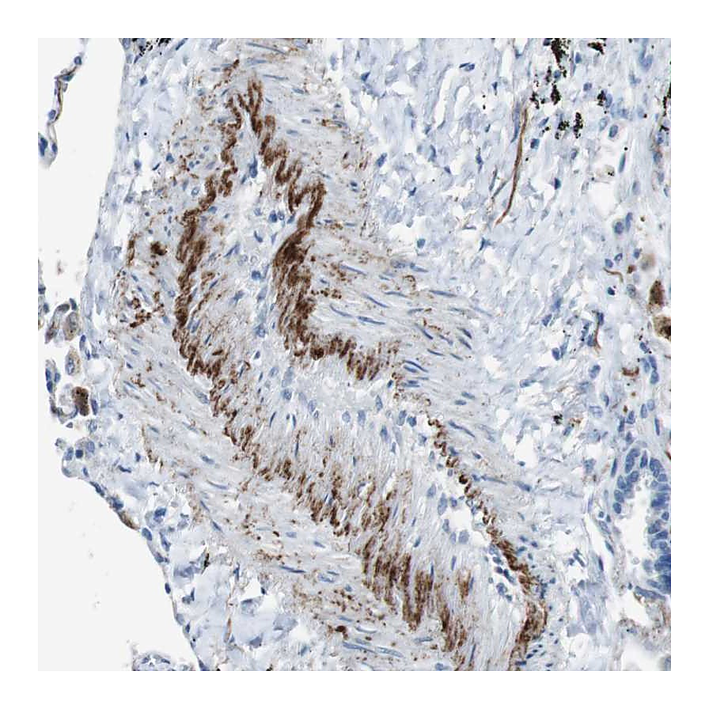 Atlas Antibodies Anti-APOBEC4 Antibody