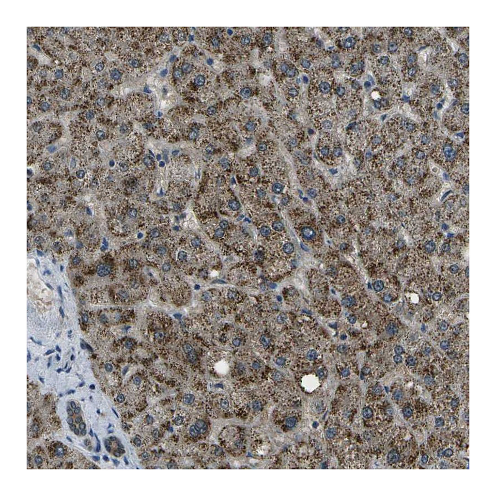 Atlas Antibodies Anti-APOBEC4 Antibody