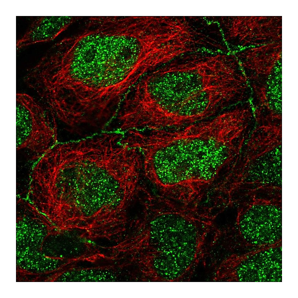 Atlas Antibodies Anti-APOC3 Antibody