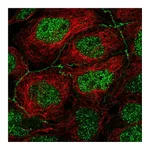 Atlas Antibodies Anti-APOC3 Antibody
