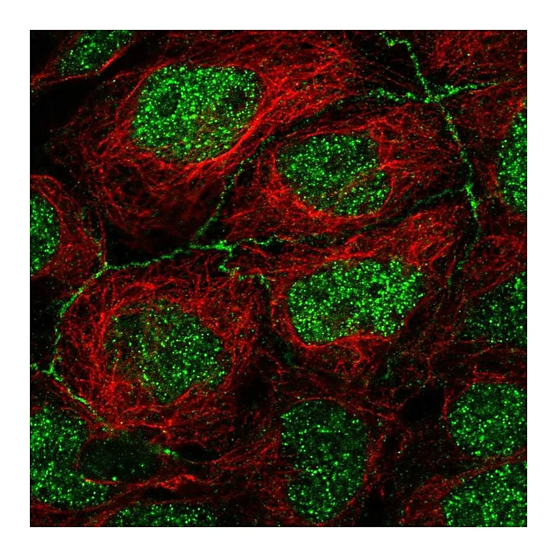 Atlas Antibodies Anti-APOC3 Antibody