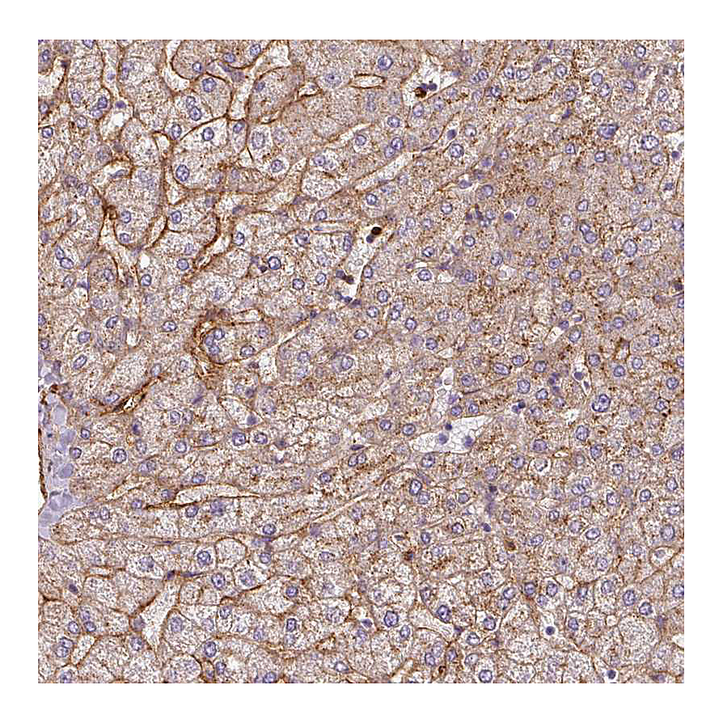 Atlas Antibodies Anti-APOC1 Antibody