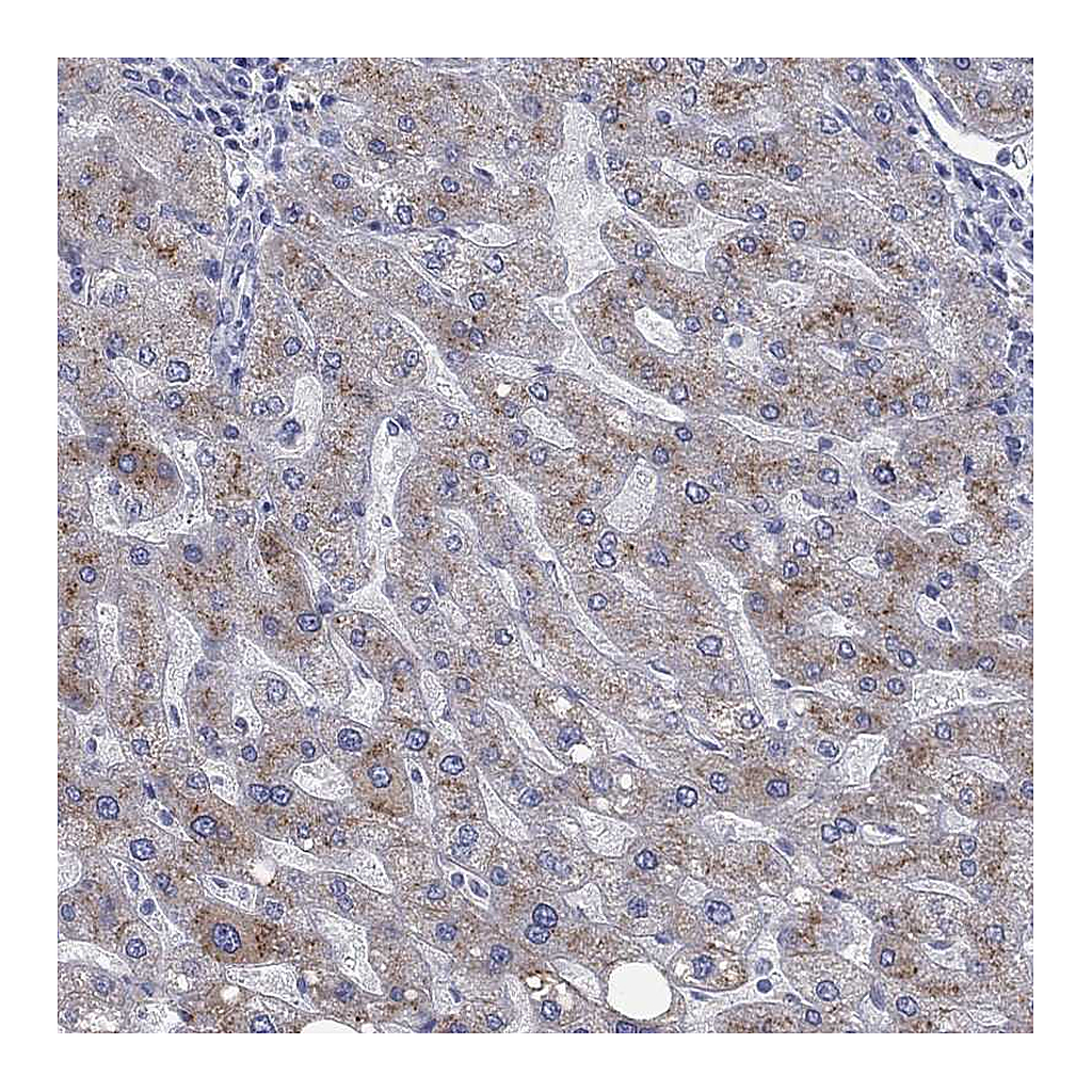 Atlas Antibodies Anti-APOC3 Antibody