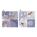 Atlas Antibodies Anti-APOH Antibody