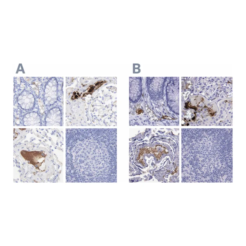 Atlas Antibodies Anti-APOH Antibody