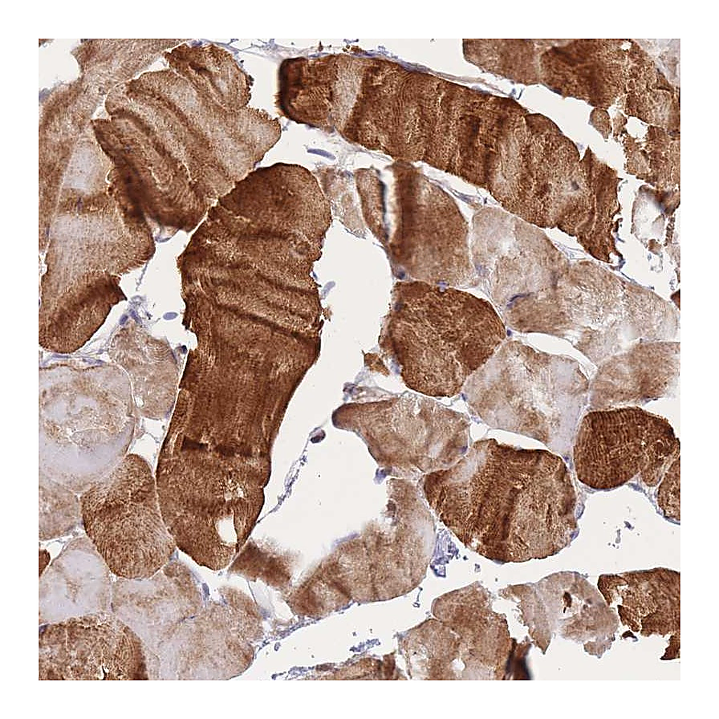 Atlas Antibodies Anti-APOL4 Antibody