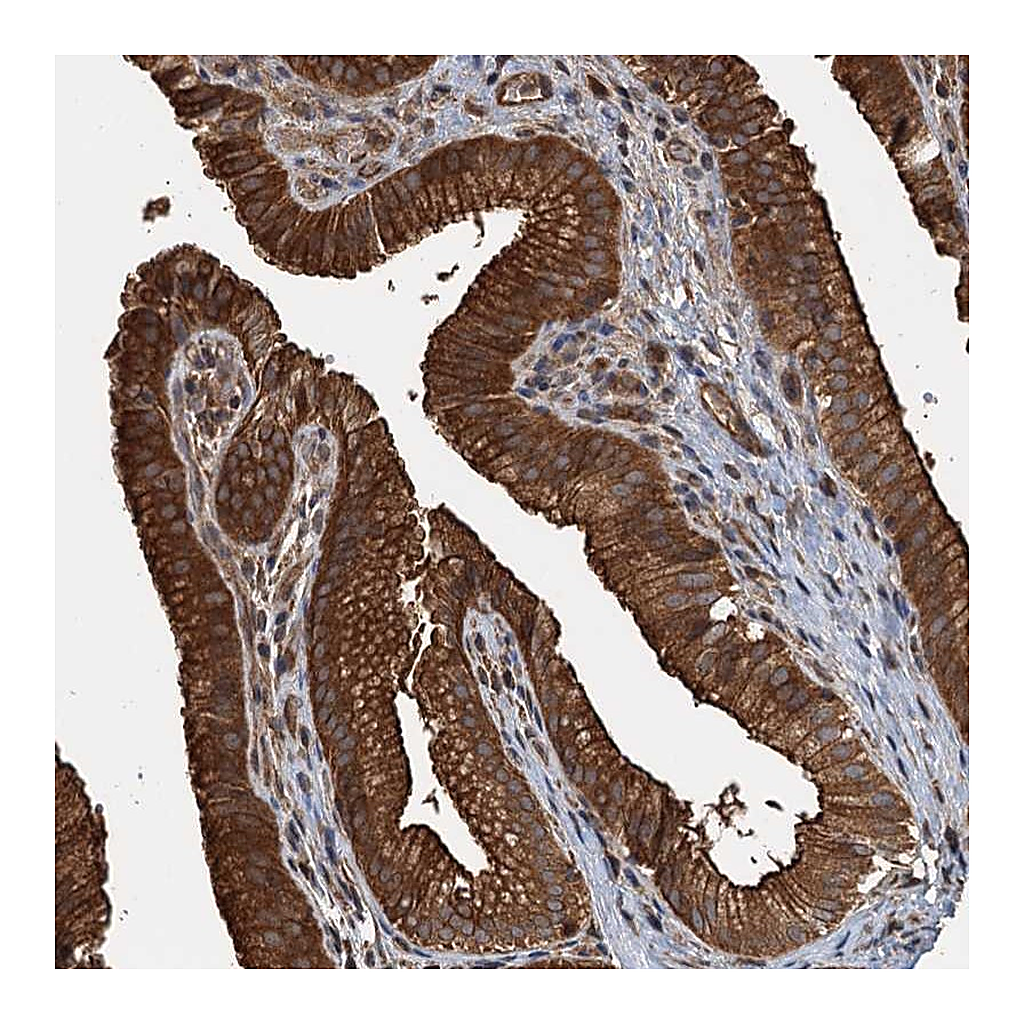 Atlas Antibodies Anti-APOL5 Antibody