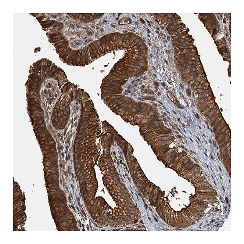 Atlas Antibodies Anti-APOL5 Antibody
