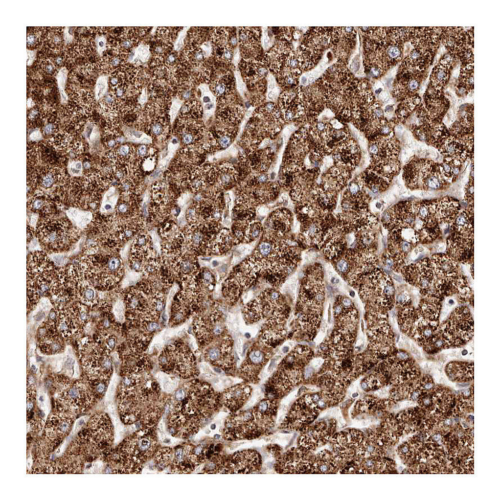 Atlas Antibodies Anti-APOL6 Antibody
