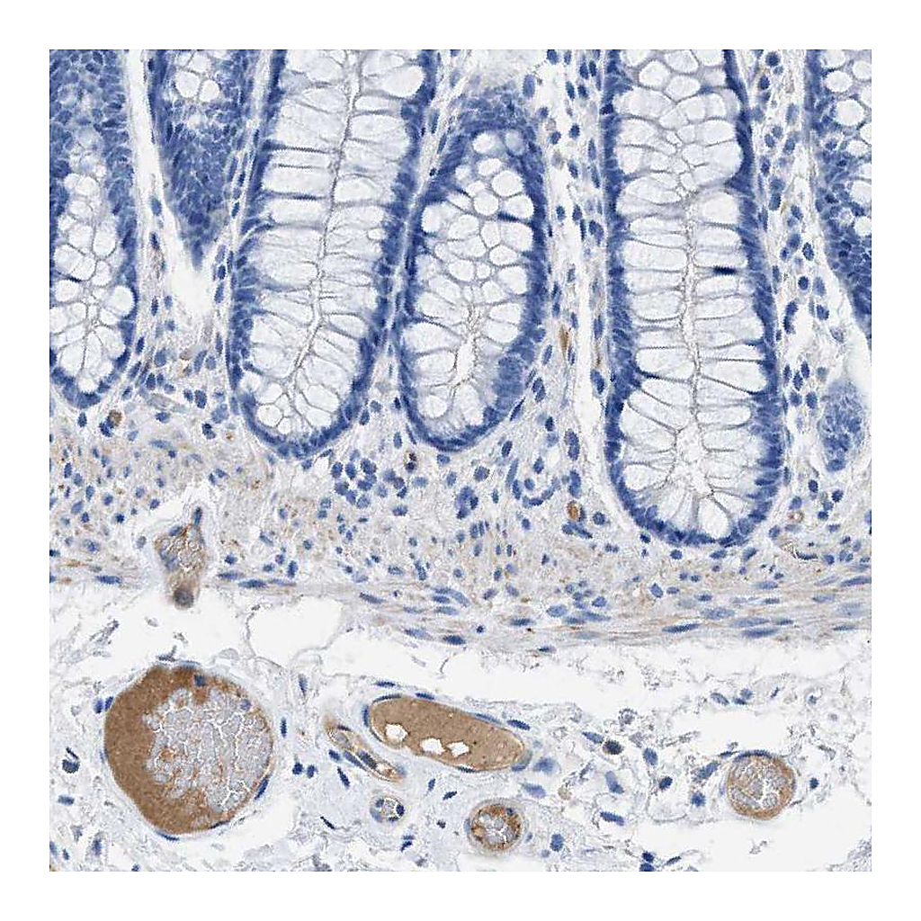 Atlas Antibodies Anti-APOL1 Antibody